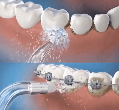 Irrigador dental portátil 4 en 1